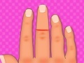 Game Finger surgery