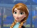 Game Frozen Anna Dentist